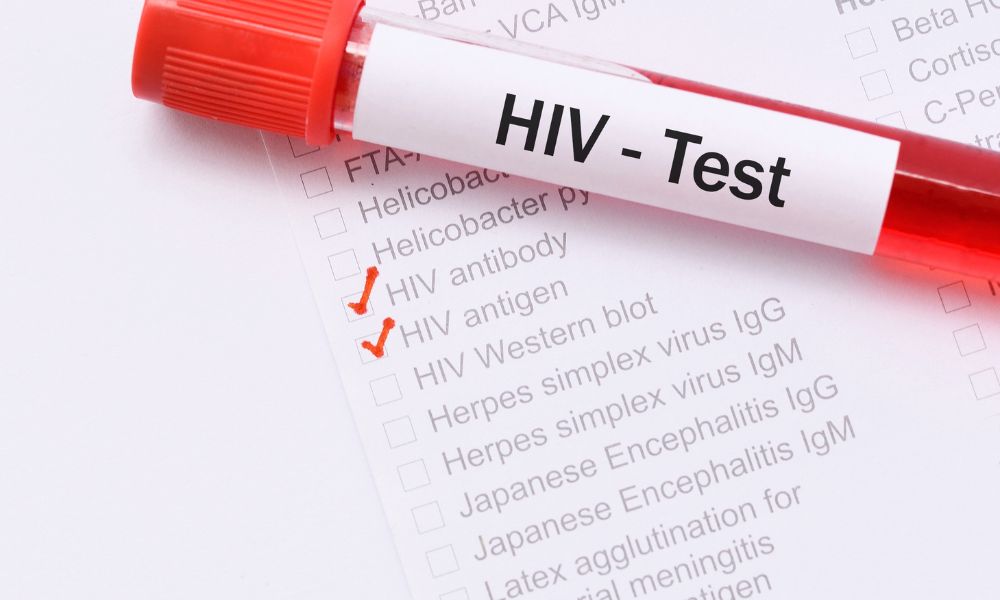 Importancia de realizarse la prueba de VIH